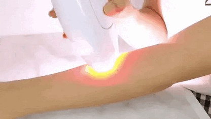 ✨🌸 Depiladora Láser IPL