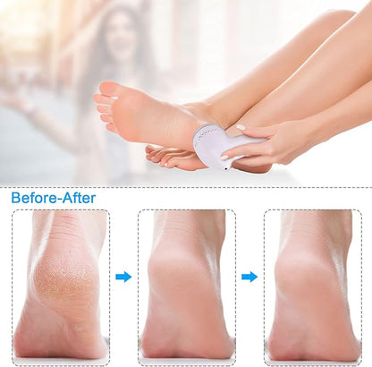 👣✨ Lima Eléctrica Removedora de Callos – Pies Suaves en Minutos