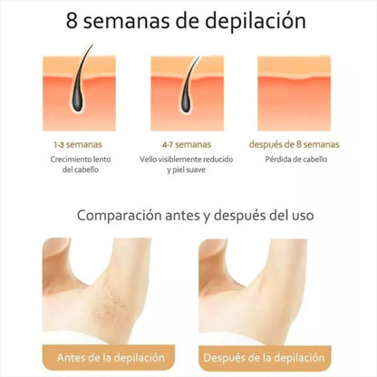 ✨🌸 Depiladora Láser IPL